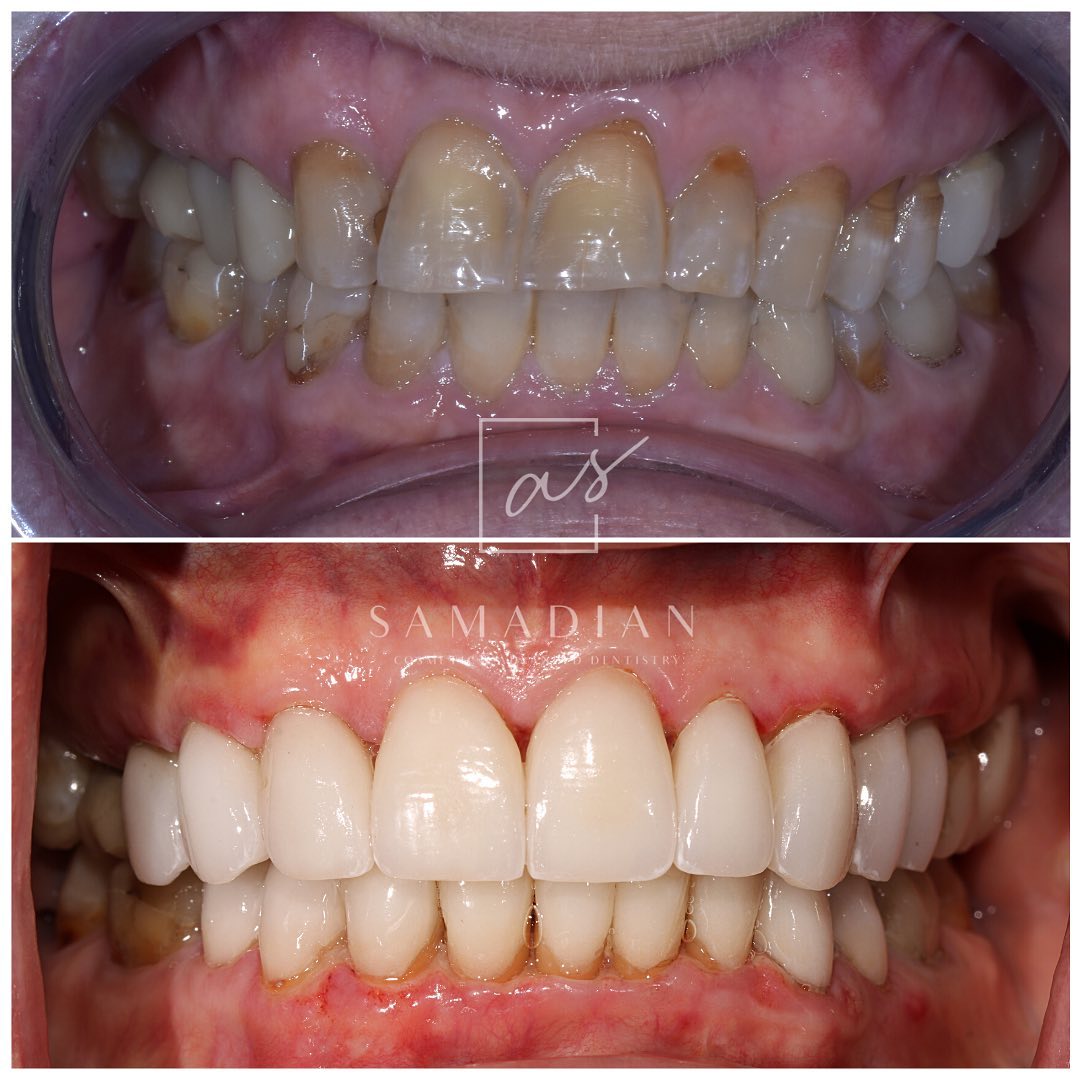 Patient Before After Image